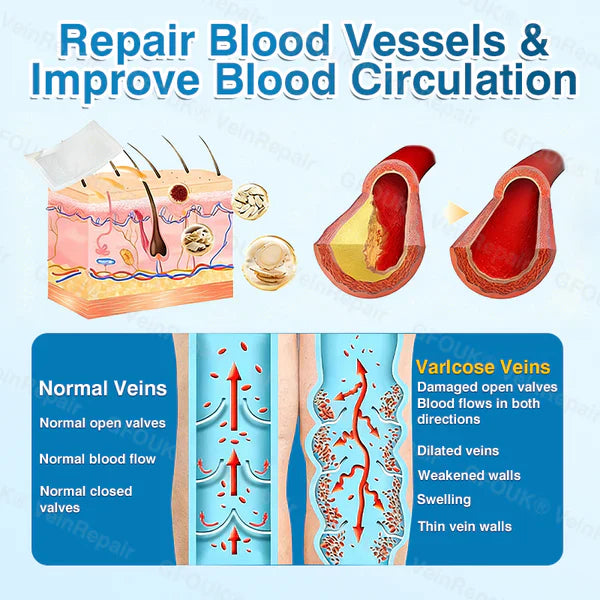 US✅🌱 VeinRepair Microneedle Patch Roll⚡Instant Relief, Long-Term Results