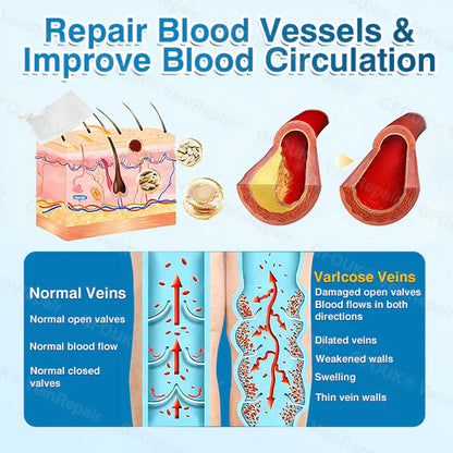 US✅🌱 VeinRepair Microneedle Patch Roll⚡Instant Relief, Long-Term Results